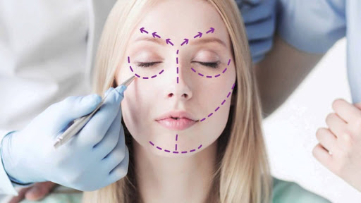	liposuccion facial cdmx