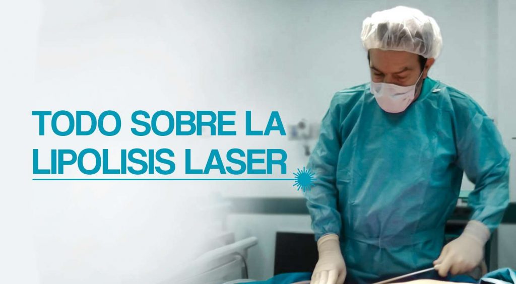 liposuccion laser antes y despues